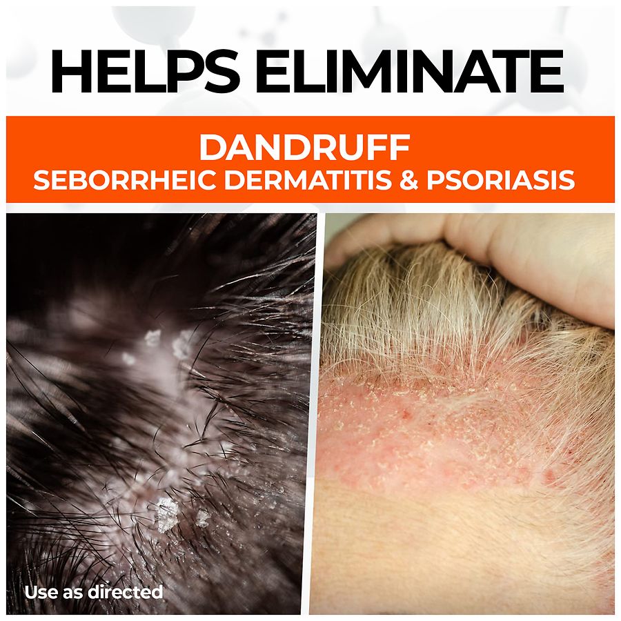 Medicasp Therapeutic Dandruff Shampoo Walgreens